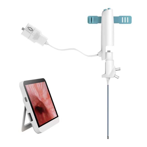 Non-invasive disposable electronic endoscope for gallbladder-preserving stone removal